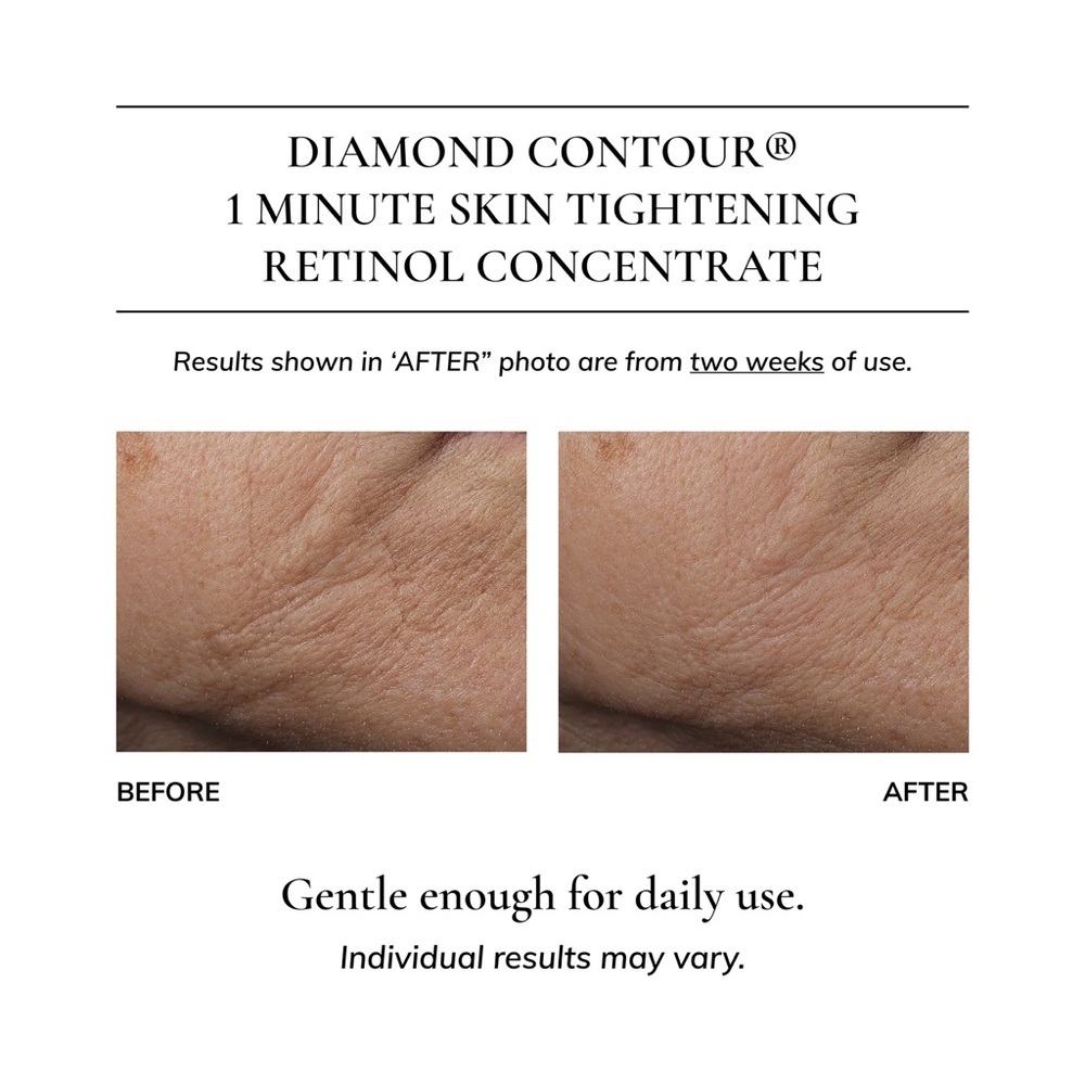 🎀 Kaplan MD Diamond Contour Retinol Concentrate 50ml ✨ Brand New In Box 🎀 - Picture 7 of 10